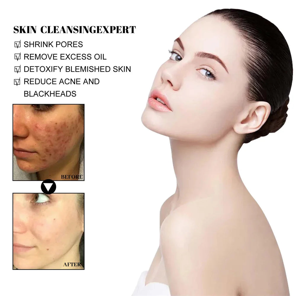 West Month Blackhead Mud Mask Oil Control Pore Cleansing Treatment